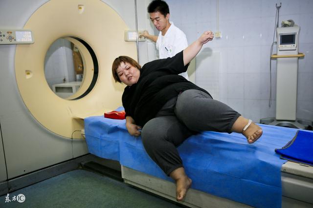 中国是“世界第二大肥胖国”！关于“肥胖”这些常识你知道吗？