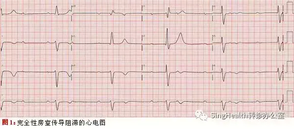 新一代无线心脏起搏器——Micra心脏起搏器