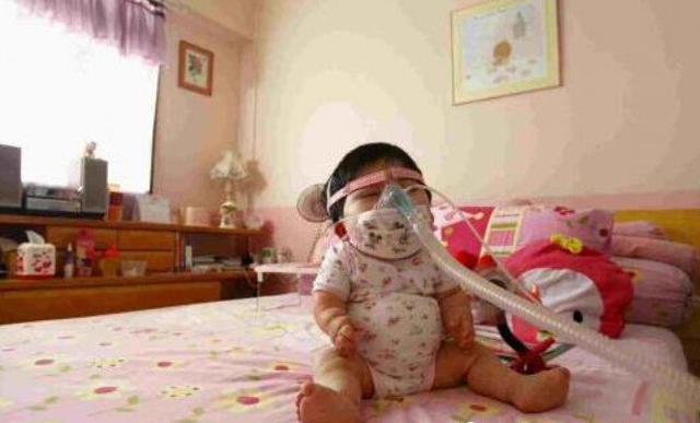 新加坡女孩患怪病永远无法长大