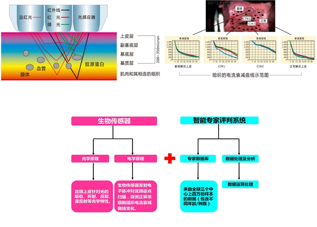 人工智能两癌筛查