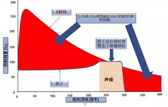 新加坡前外长夫人在MD安德森完成鼻窦癌治疗，目前已无癌症迹象