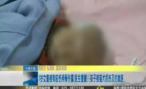 狗没咬人，狗的主人却被判赔23万！网友：这太少了！