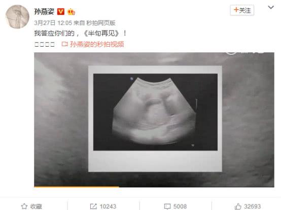 孙燕姿把二胎宝宝B超影像做成新单曲预告，粉丝：生完开演唱会