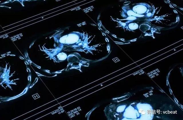 被两家亚洲集团联合收购，RADLogics的算法25秒可扫描2000张图像