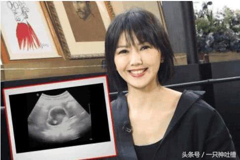 孙燕姿40岁拼二胎，八个月孕照曝光，仍然很美，V脸女神