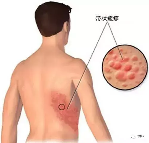 疼痛指数爆表！不要被“蛇”伤害