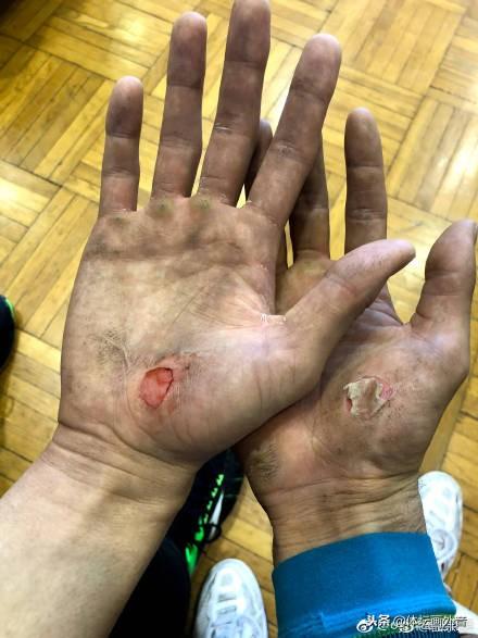 男排小将不仅被主帅猛砸还挨巴掌 但比这些更可怕的是心理伤痕