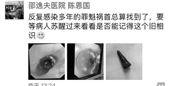 吃惊！肺部感染这么可怕，快来学习如何科学预防