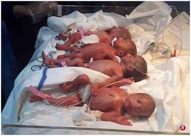 伊拉克25岁女子顺产7胞胎诞下6女1子 系该国首例