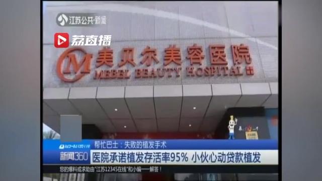 小伙贷款25000元种了2500根头发，一个月后掉一半