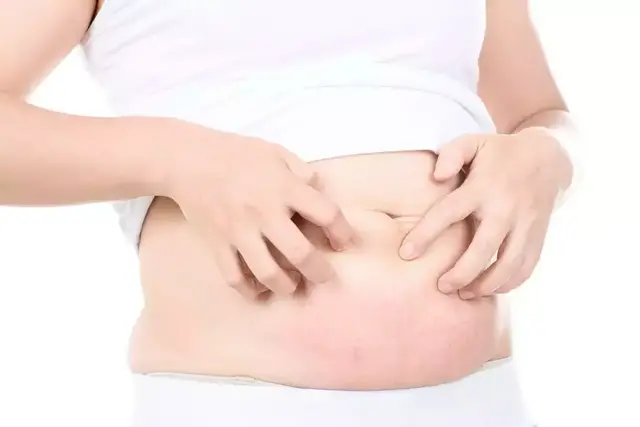 【答个疑】孕期皮肤痒怎么办？弄清原因很重要