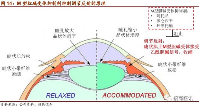 近视控制行业深度报告--近视防控势在必行，干预手段首推OK镜