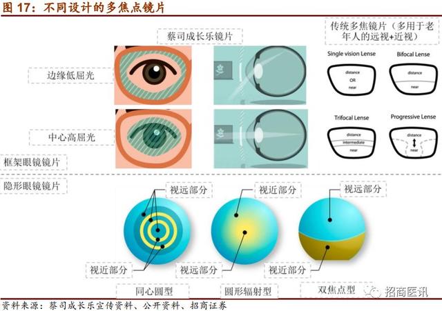 近视控制行业深度报告--近视防控势在必行，干预手段首推OK镜