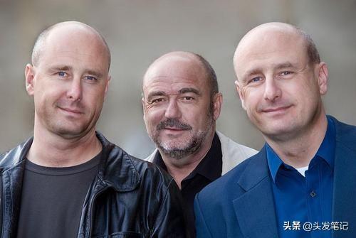 匿名口述：脱发后给我的生活带来的困扰！