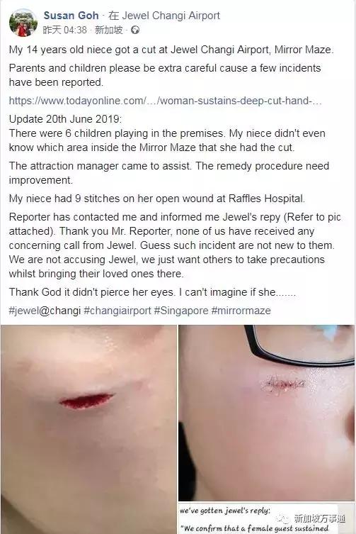 新加坡机场又双叒叕突发意外事故，小女孩脸被割伤缝9针险被毁容