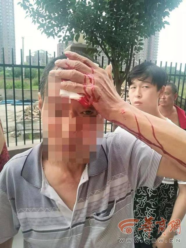 高空坠下指甲油瓶砸得老人满脸血却无人承认 高空抛物能否入刑