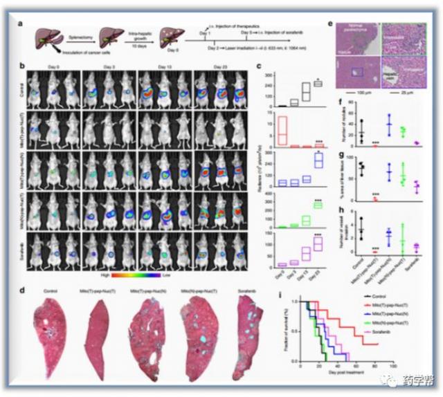 Nat. Comm.：南京大学蒋锡群、胡勇等发现杀死肝转移癌细胞的方法