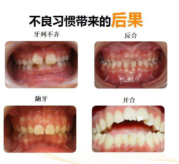 爱牙日│儿童口腔健康，从这些“小事”开始