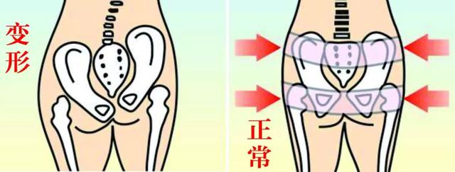 骨盆健康对女性的意义