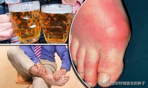 痛风应该吃什么食物好？蔬菜能不能吃？水果、坚果是否可以摄入呢
