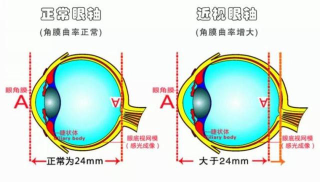 世界视力报告｜点名中国孩子，都玩手机，为何美国近视率只有我们1/7