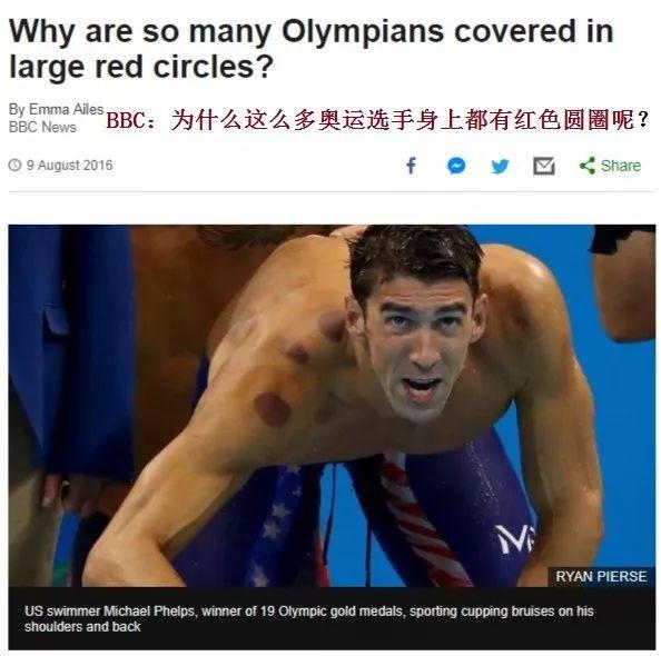中医的“朋友圈”越来越大 原来这群外国人这么喜爱中医？