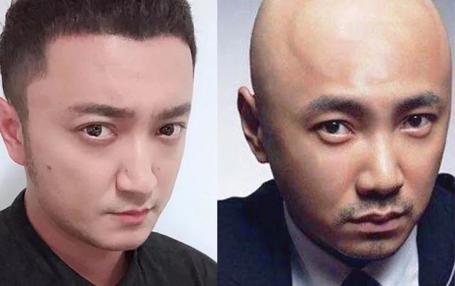 张一山长大后成了夏雨：撞脸不可怕，关键靠实力说话