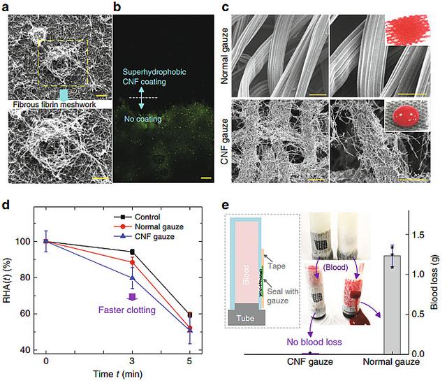 新型超疏水纱布——快速止血、防感染、不粘伤口