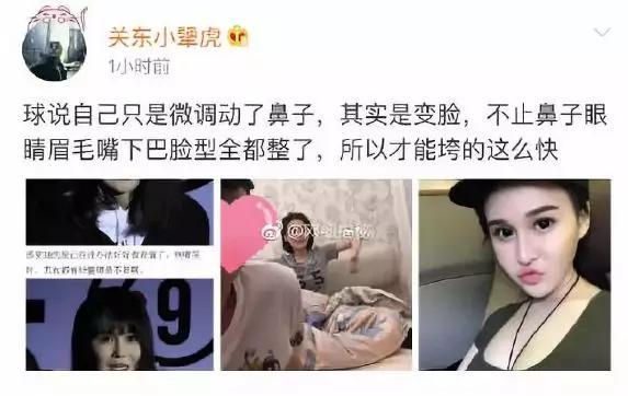 赵本山闺女整容后被骂，任正非女儿"换脸"成最美千金，同为名人