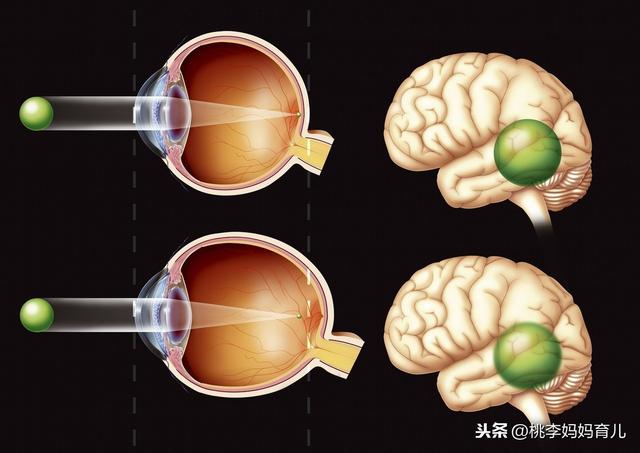 科学家研究成果：预防孩子近视的最好办法！早知道早干预