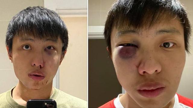 别把新冠病毒带进来！新加坡留学生因疫情受歧视，伦敦街头被暴打