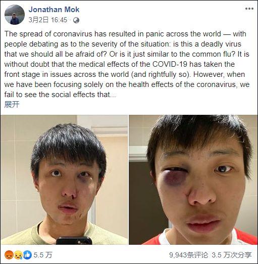 “别把新冠病毒带进来”，新加坡留学生在伦敦街头被暴打