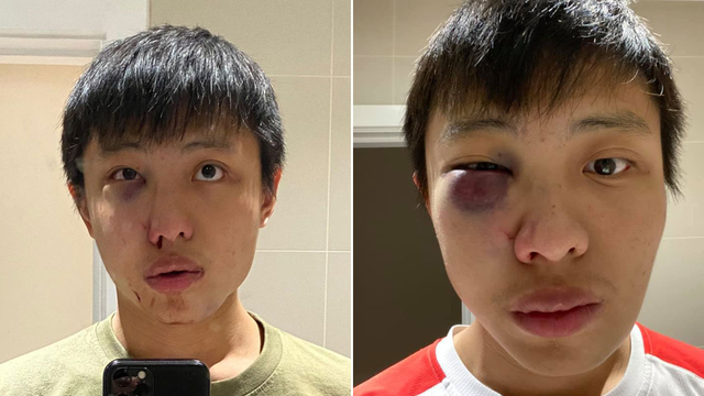 新加坡留学生因新冠疫情在伦敦遭围殴，英国警方公布4名嫌犯照片