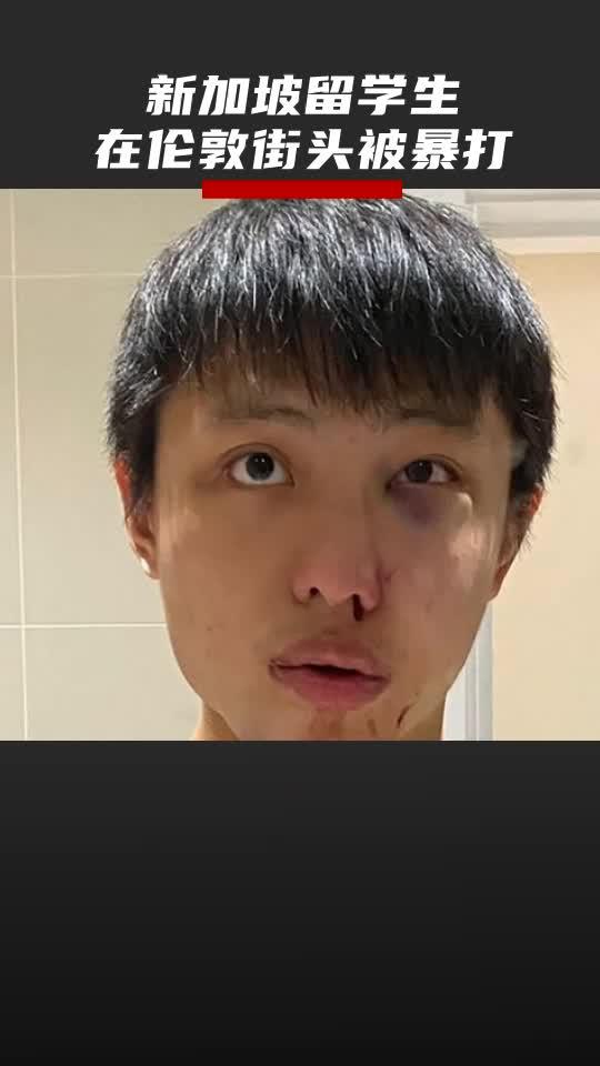“别把新冠病毒带进来！”新加坡留学生在伦敦街头被暴打