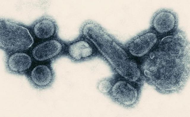 冠状病毒将在全球范围内带来四波传染——西班牙流感的启示​
