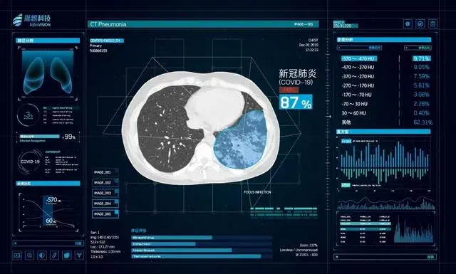 疫情之下，AI成全球战“役”得力助手