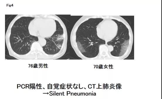 “无症状感染者”传播病毒能力有多强？科学家有这些发现