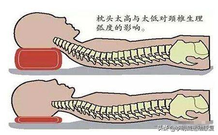 颈椎病的日常护理有哪些?