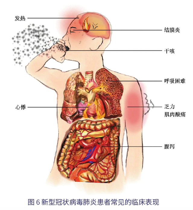 海外留学人员新型冠状病毒防控指南