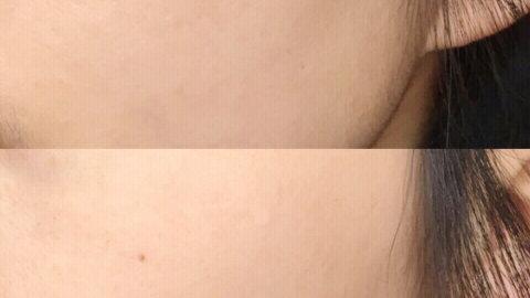 淡斑秘诀丨磁力小哑铃神助攻👯‍♀️👯‍♀️👯‍♀️