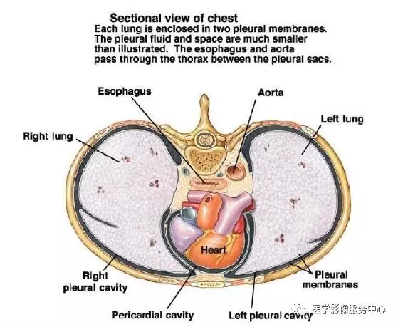 CT检查发现的胸水一定就是胸水吗？你可千万别误诊了