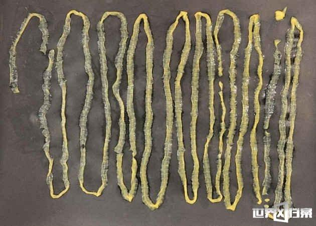 新加坡男子吃三文鱼刺生后排出2.8米长绦虫