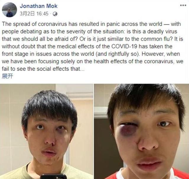 英国殴打新加坡留学生少年被控，罪名涉及种族歧视