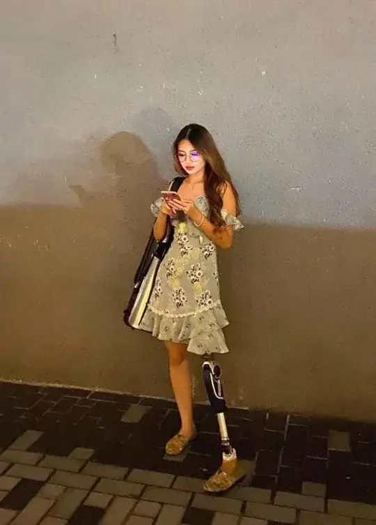 13岁因骨癌截肢 马来西亚“单脚美女”成游泳健将攻读古典音乐