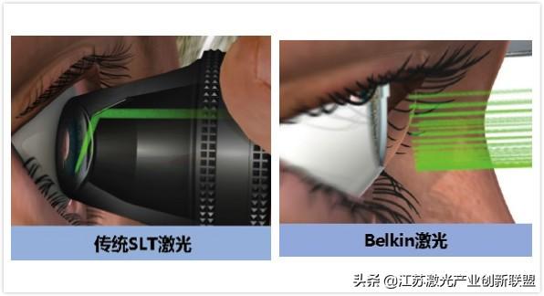 BELKIN Laser最终完成总金额为1225万美元的B轮融资