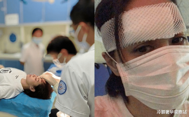 阿娇头缝66针心如摔崩下巴卡梅隆撞碎鼻骨这些明星无惧天妒美貌