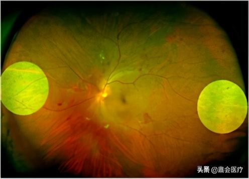 每只眼睛都是一个美丽星球，这些致盲性伤害，医生带你远离