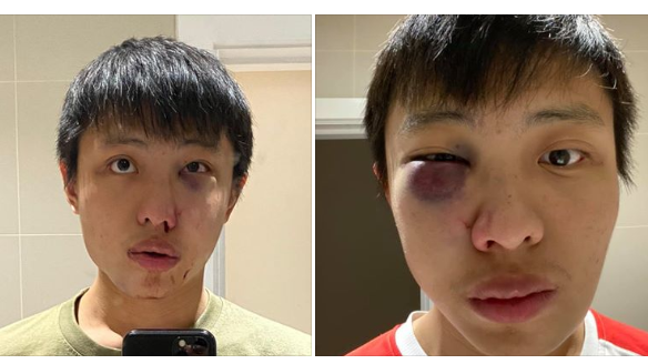 新加坡留学生伦敦遇袭，英少年被判收容管教18个月