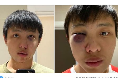 亚裔留学生因疫情受歧视遭殴打，判决结果下来了，英网友：不满意