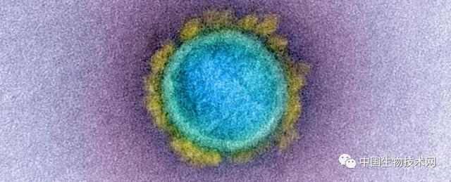 美国传染病专家：人类必须要保持谦卑，主动预测和识别病毒以避免下一个大流行